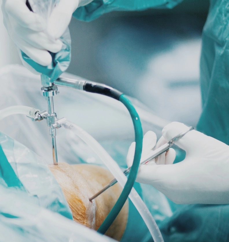Knee Arthroscopy