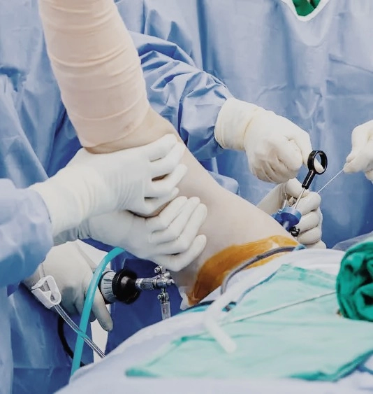 Shoulder Arthroscopy