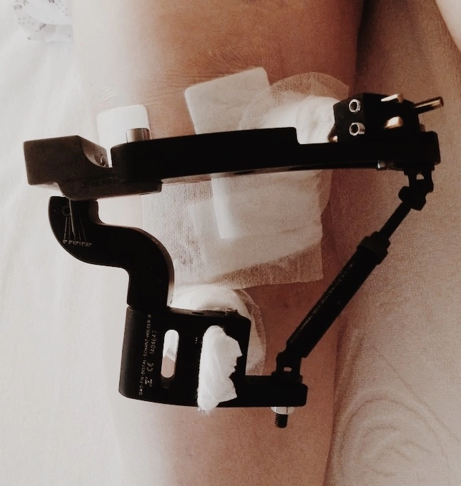 Deformity Correction Surgery